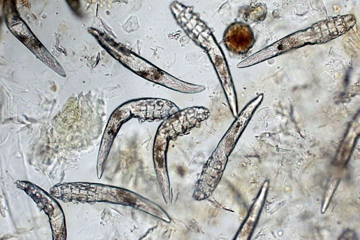 Демодекс. Демодекоз (угревая Железница). Demodex canis под микроскопом. Клещ Железница (Demodex folliculorum).