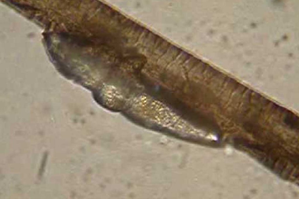 Глазной ресничный клещ Demodex паразит