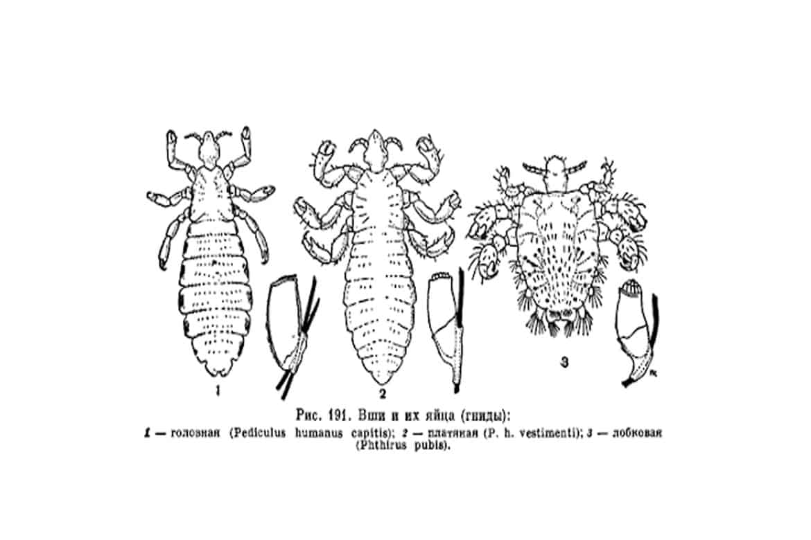 Вошь лобковая рисунок с обозначениями