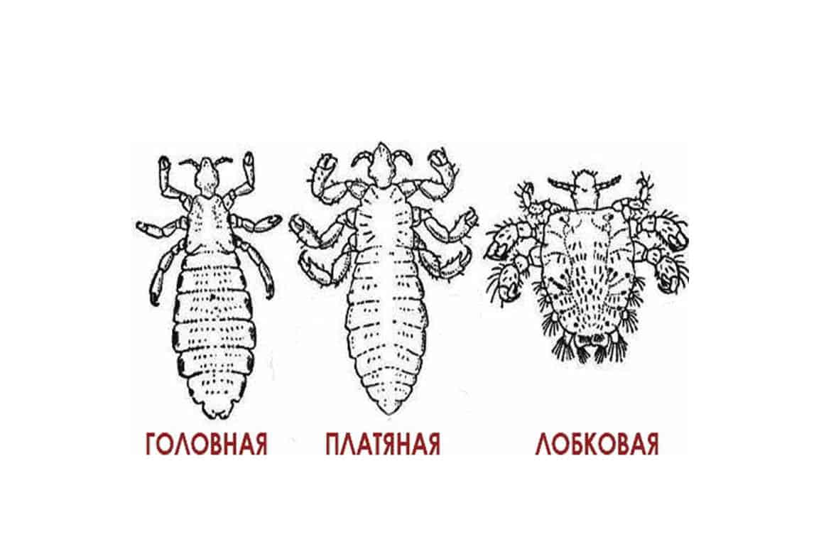 Вошь лобковая рисунок с обозначениями