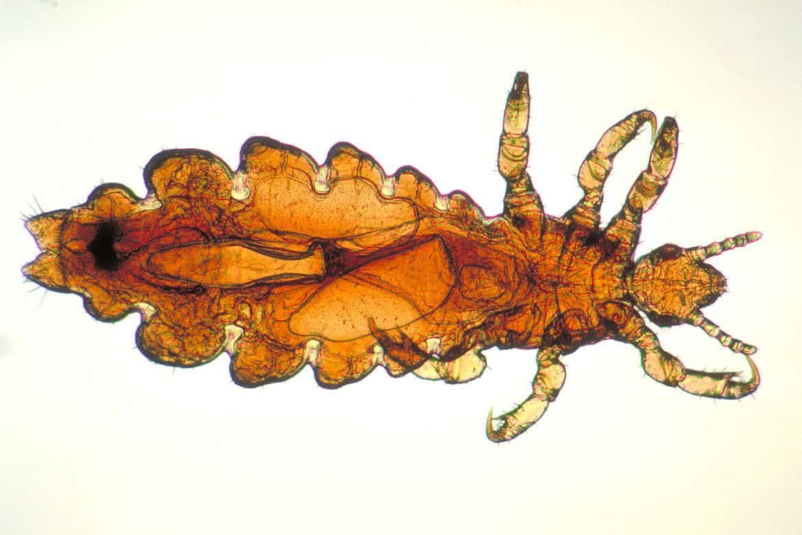 Картинка вши головной под микроскопом