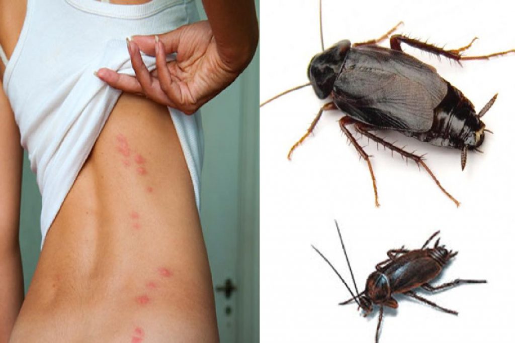 Чёрные канализационные тараканы аллергия